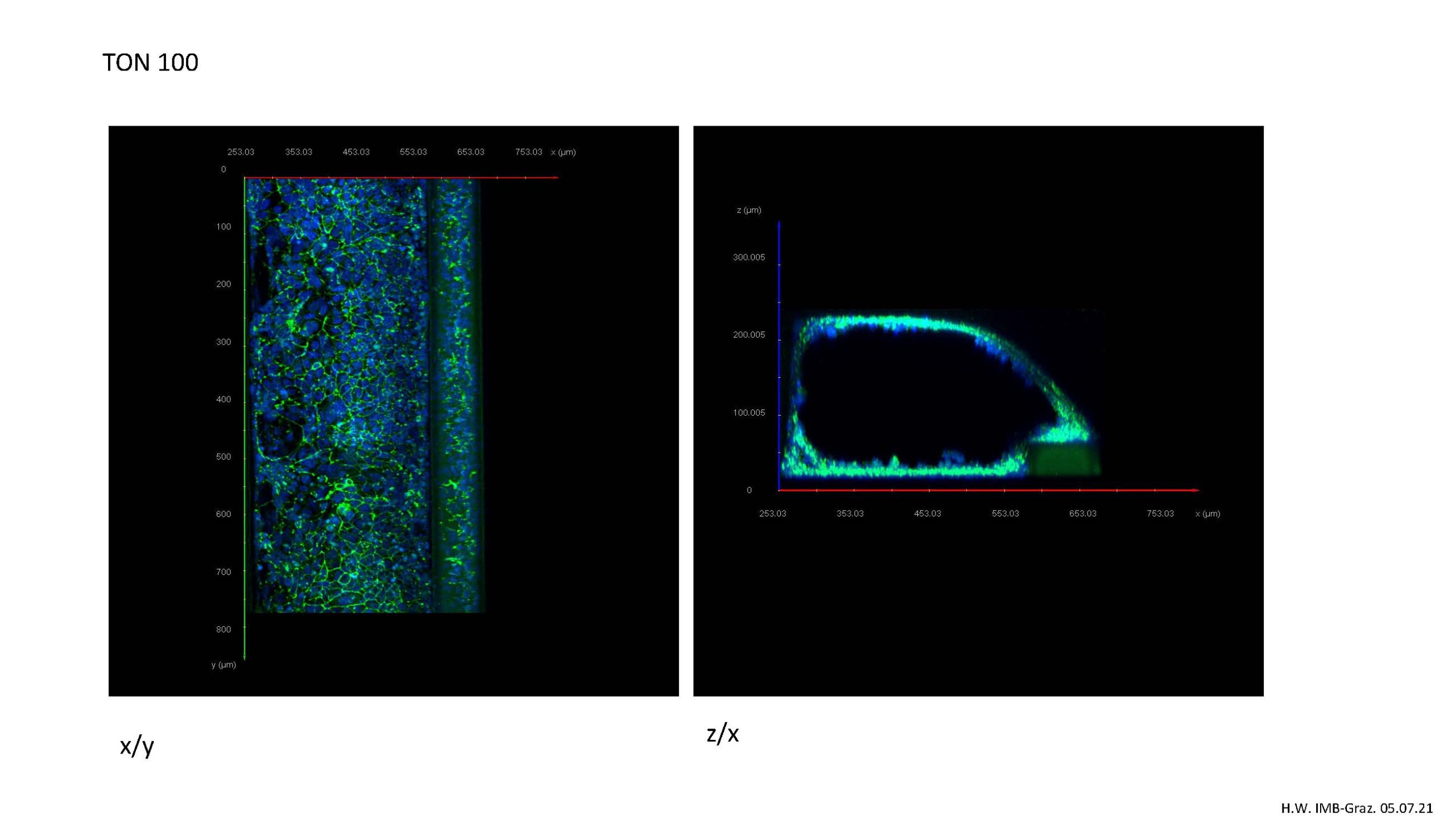 Der Minidarm im Chip: Längs- (links) bzw. Querschnittsaufnahme (rechts) eines mit Immunfluoreszenz gefärbten 3D-Darmröhre (anti-Zonulin 1) erstellt von Mag. Dr. Heimo Wolinski, IMB, Karl-Franzens-Universität Graz.