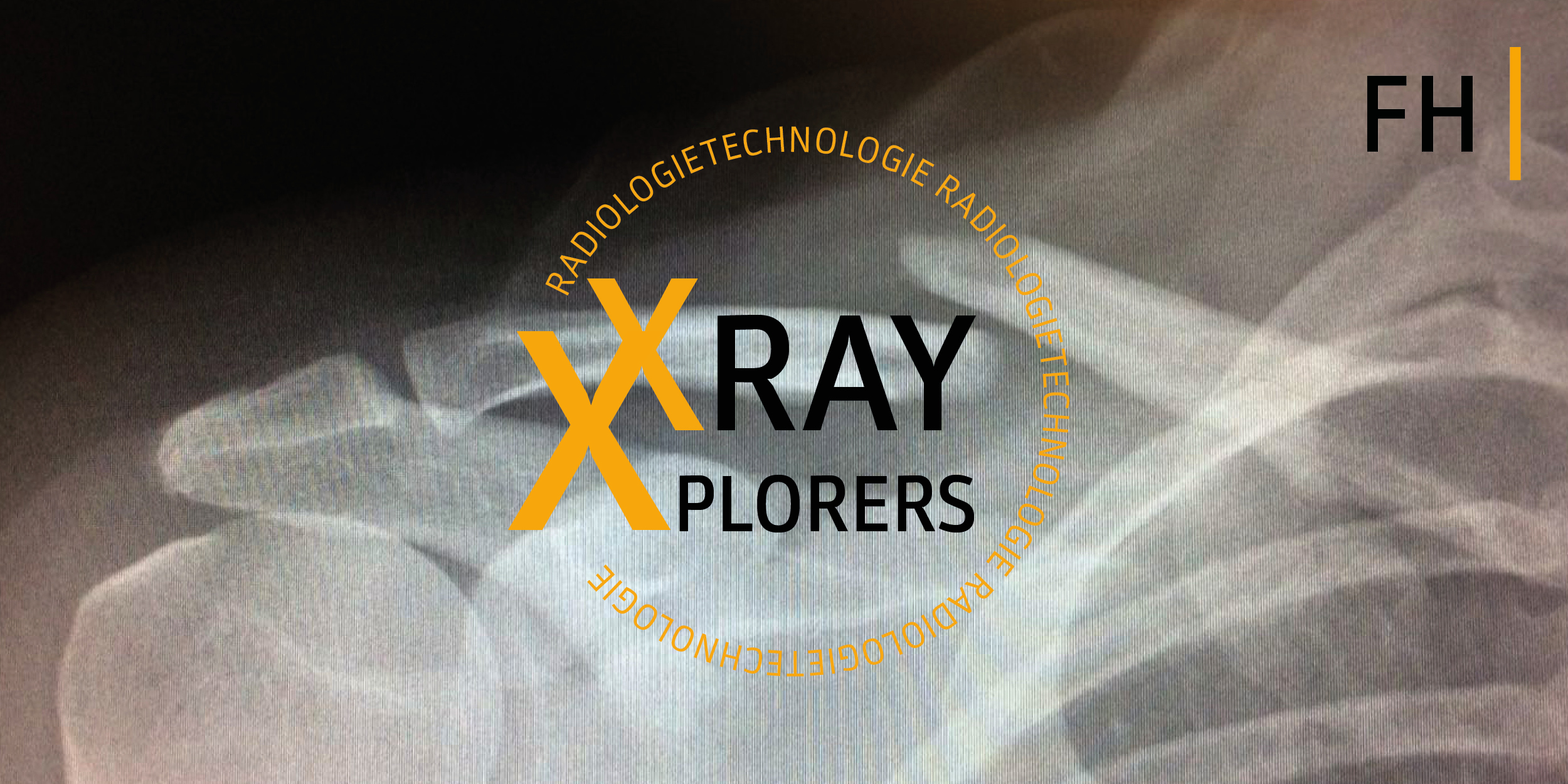 Zu sehen ist ein Röntgenbild und das Logo der Videoreihe X-ray X-plorers